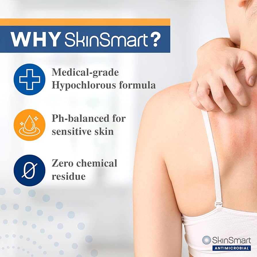 SkinSmart Eczema & Rosacea Relief Hypochlorous Spray