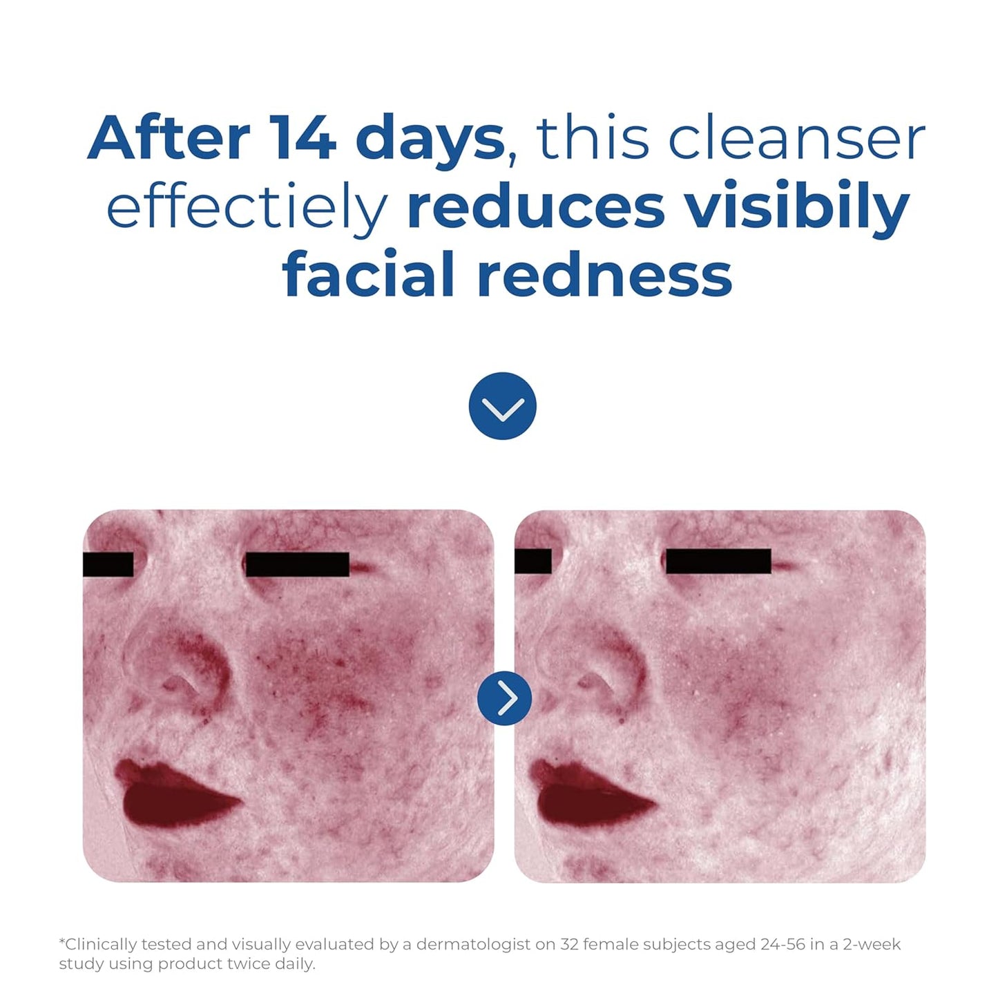 EltaMD Skin Recovery Amino Acid Foaming Cleanser