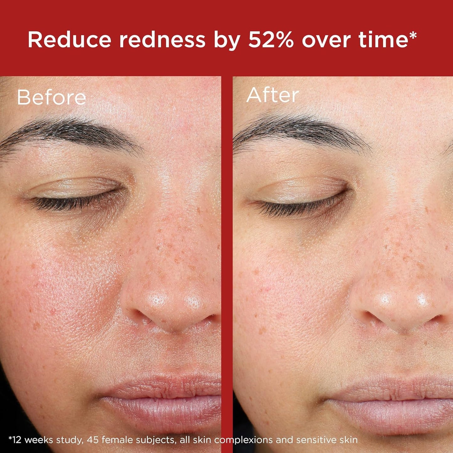 EltaMD UV Skin Recovery Mineral SPF 50 Face Sunscreen