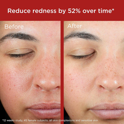 EltaMD UV Skin Recovery Mineral SPF 50 Face Sunscreen