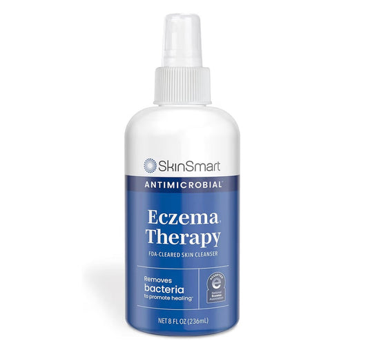 SkinSmart Eczema & Rosacea Relief Hypochlorous Spray