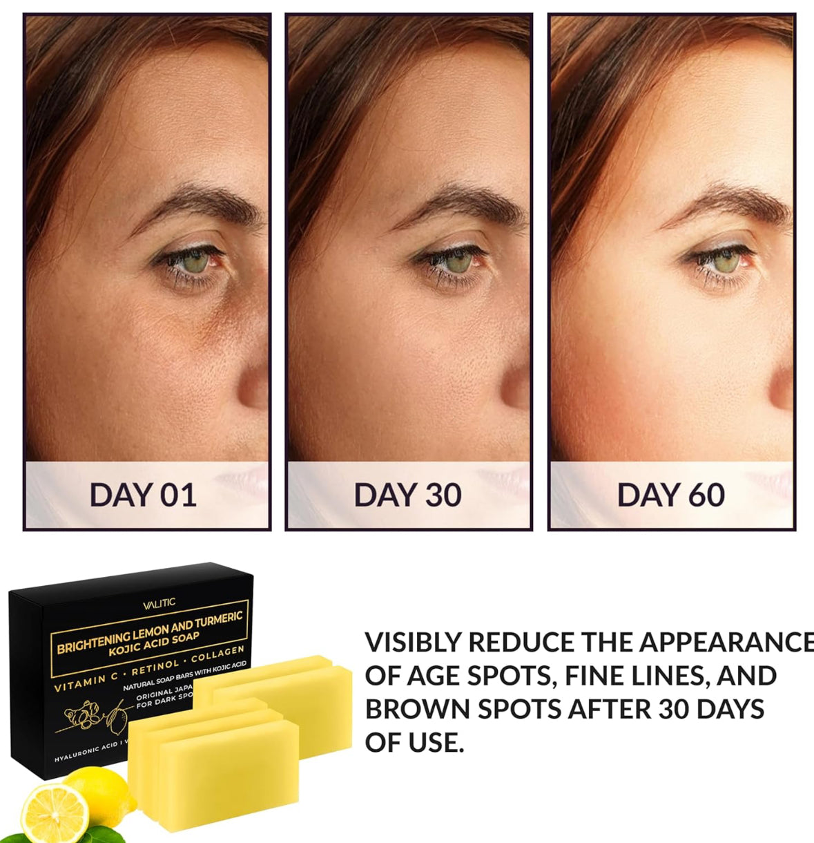 VALITIC Lemon, Turmeric & Kojic Acid Brightening Soap (2 Pack)