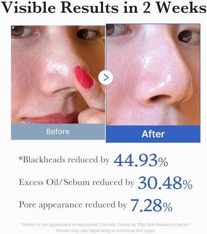 Medicube Zero Pore Pad 2.0 with BHA, AHA & Lavender