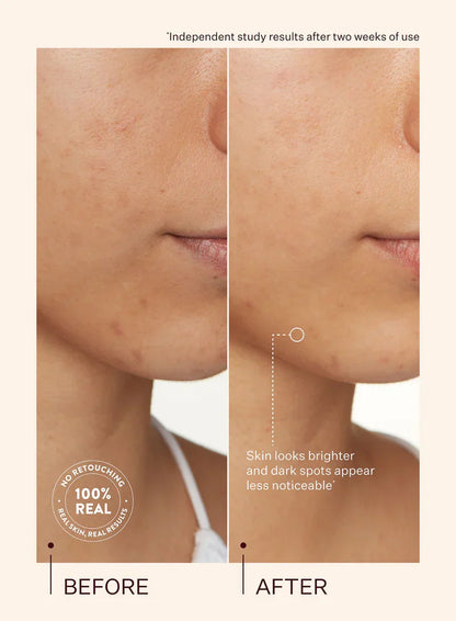 Peach & Lily Transparen-C Vitamin C Dark Spot & Acne Treatment
