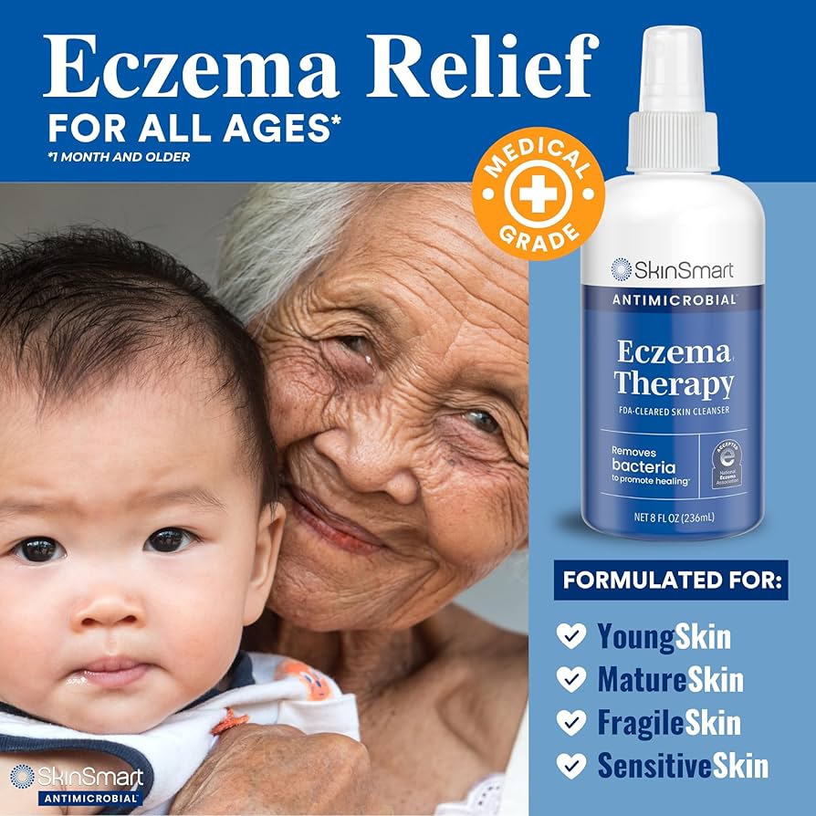 SkinSmart Eczema & Rosacea Relief Hypochlorous Spray
