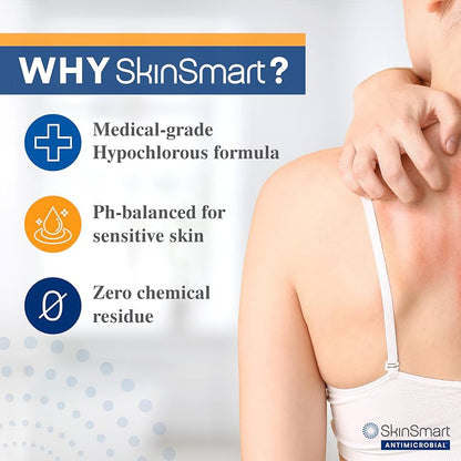 SkinSmart Eczema & Rosacea Relief Hypochlorous Spray